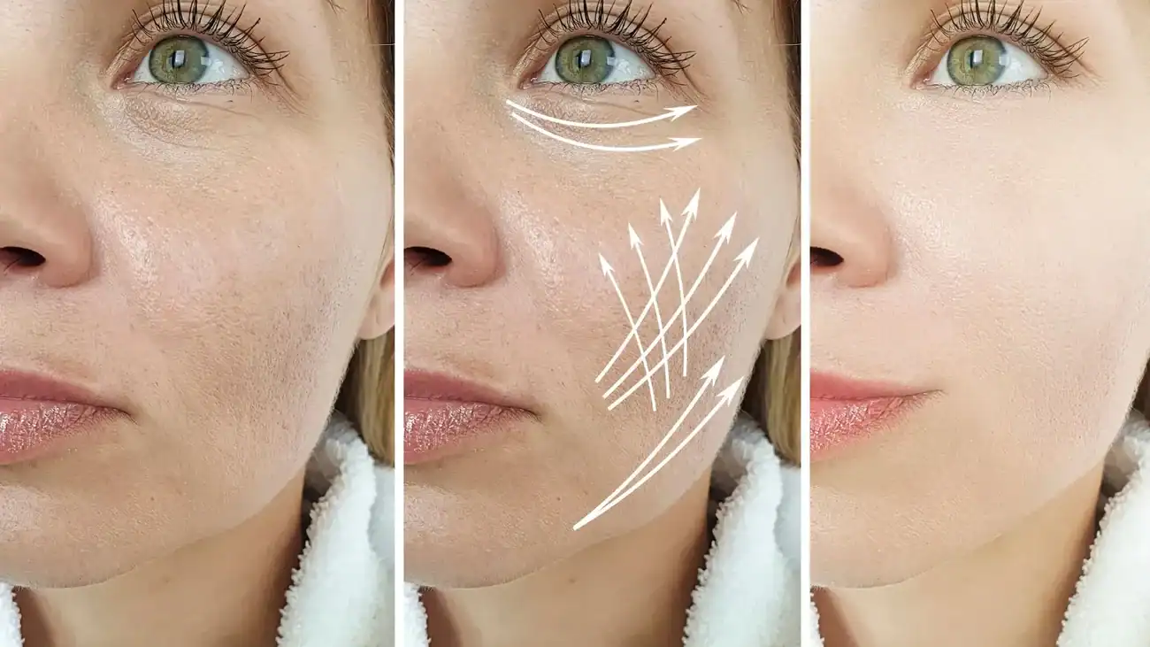 Can One Treatment Really Tackle More Than One Skin Concern Kingswinford?