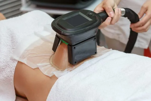 Image of person having fat freezing treatment to help weight gain Kingswinford