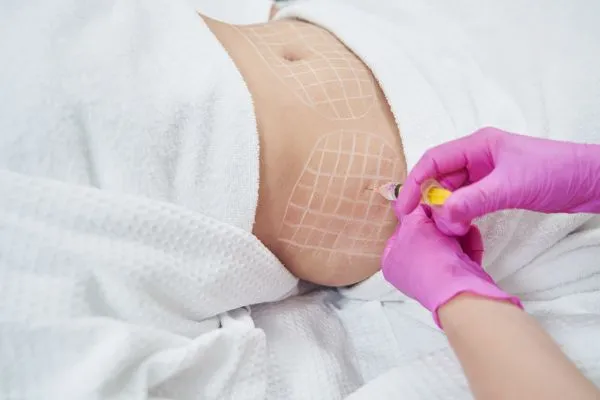 image of fat dissolving injections on love handles to help combat weight gain Kingswinford