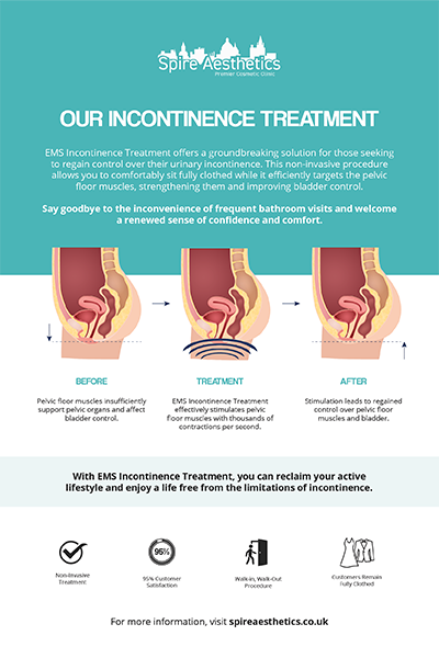 image to show how EMS treatment works for female urinary incontinence Kingswinford