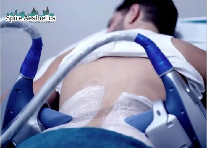 Man having fat freezing treatment done on love handles before a competitions Kingswinford to create a sculpted look.