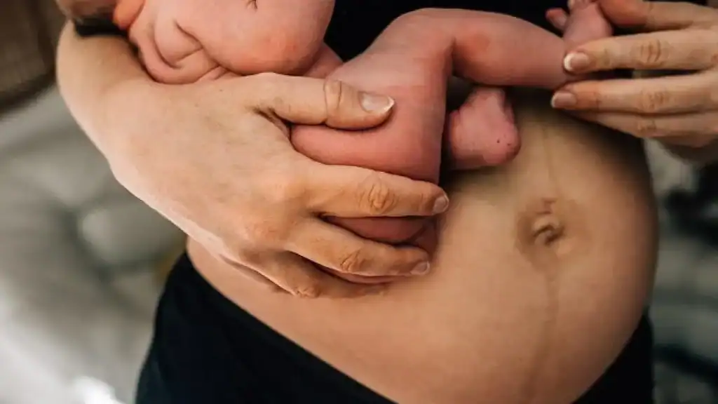Why Is My Stomach Still Big After Pregnancy Kingswinford?