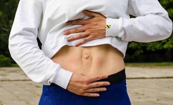 When Could Diastasis Recti Be the Missing Piece of the Puzzle Kingswinford?